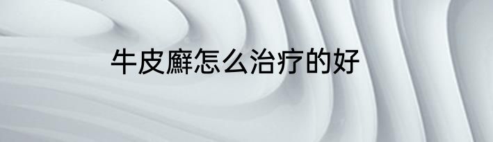 牛皮廯怎么治疗的好